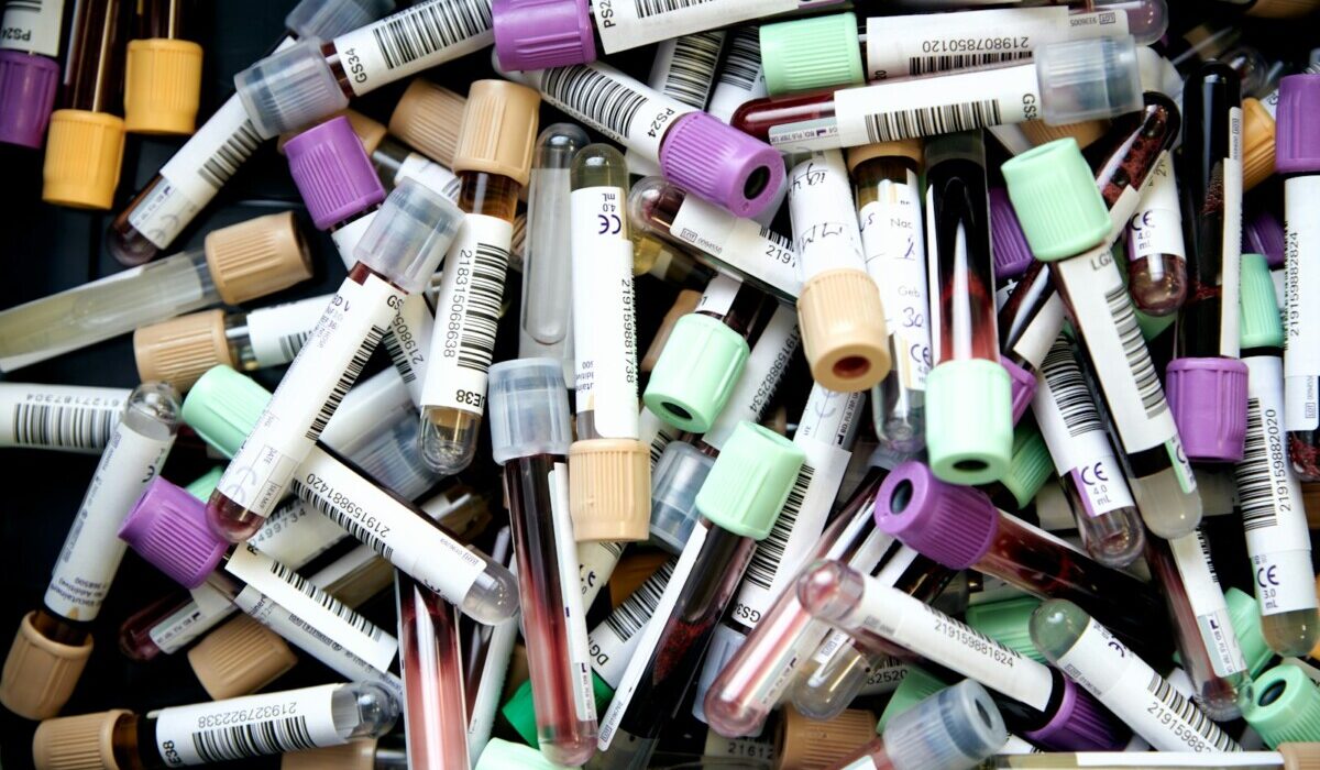 assorted color pen lot on white table